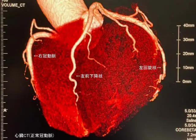 通販でクリスマス 心筋梗塞・狭心症・不整脈 多比良医院 成増 | 医学一般